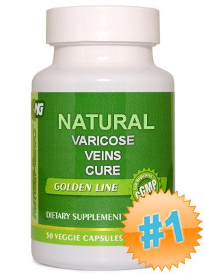 Natural Cure for Varicose Veins